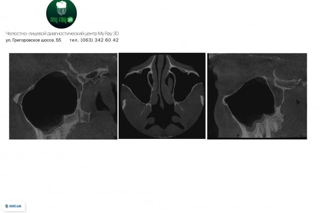 MyRay3D, центр диагностики челюстно-лицевой области