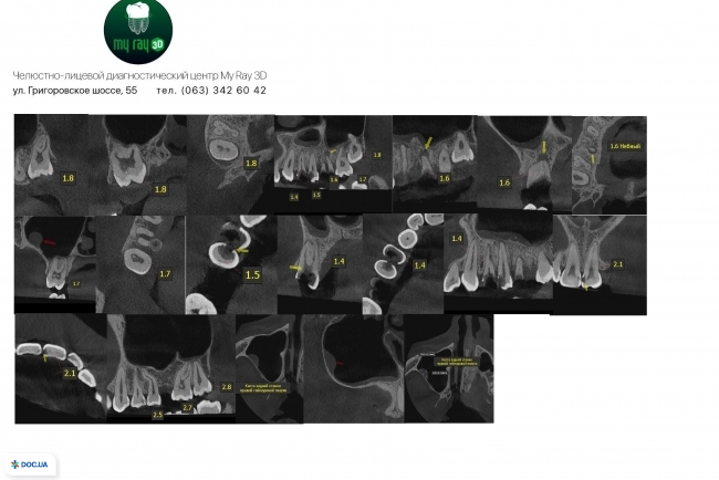 MyRay3D, центр диагностики челюстно-лицевой области