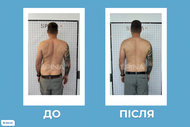 Оздоровчий центр «Спина +»  м.Деміївська