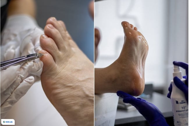 Центр подологии «Твоя Стопа» на Мазепы