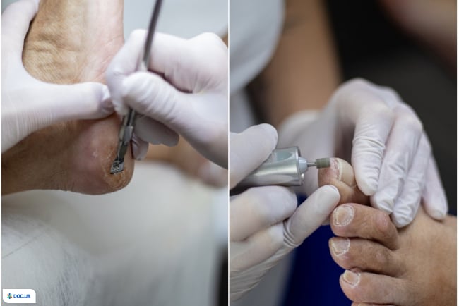 Центр подології «Твоя Стопа» на Руфа