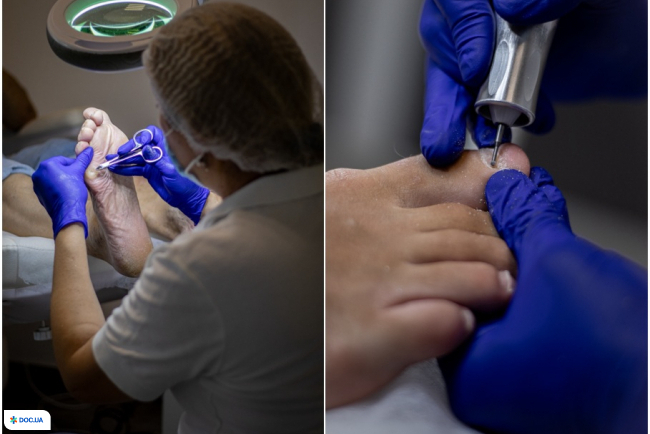 Центр подології «Твоя Стопа» на Руфа