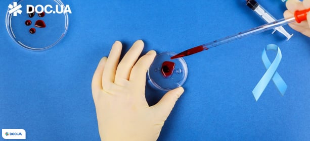 Аналіз ПСА: що показує і коли потрібно здавати