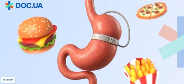 Бариатрия: главное, что нужно знать перед принятием решения