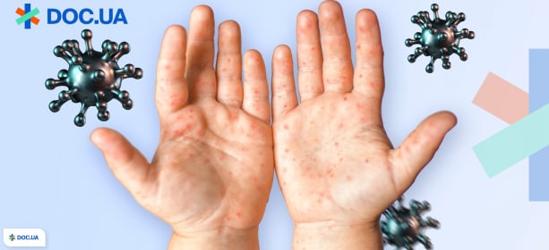 Вирус Коксаки у детей: симптомы, лечение и профилактика осложнений